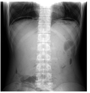 腹平片影像診斷